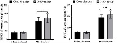 Enhanced nerve function recovery in radial nerve palsy patients with humerus shaft fracture: a randomized study of low-frequency pulse electrical stimulation combined with exercise therapy